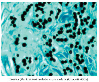 Lacazia loboi - caso clínico - raciocínio clínico