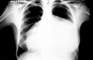 Radiografia de tórax - Caso Clínico Interativo - Raciocínio Clínico