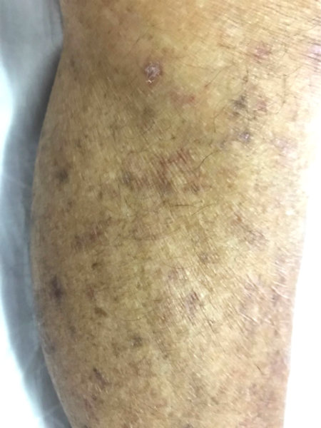 Lesão de pele - Caso clínico Interativo #03 - Raciocínio Clínico