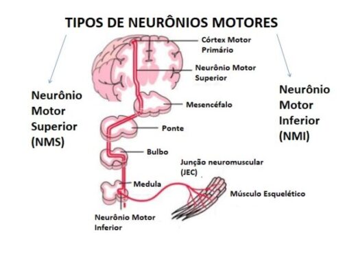 Fraqueza Muscular: Avaliação Prática E Raciocínio Clínico - Raciocínio ...